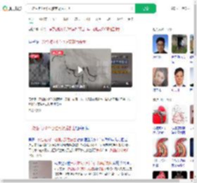 一次性植入6个心脏支架后去世_360搜索